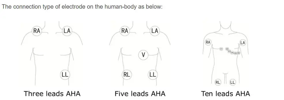 5-lülitusega EKG-juhtmed philips digitrak pluss 24-tunnine holter 3100A, 5-lülitus, Snap